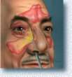 Additional Image - Endoscopic Sinus Surgery